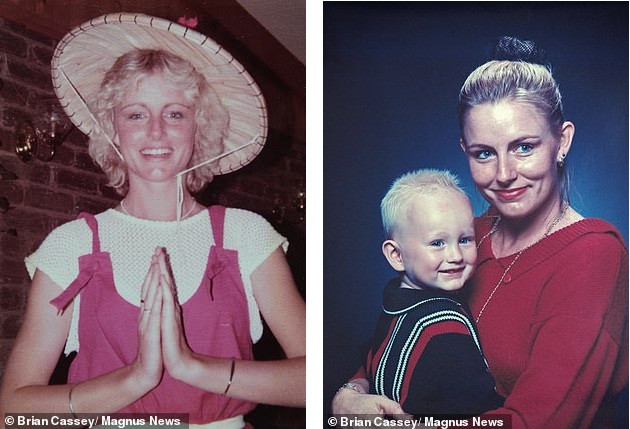 Câu chuyện xúc động sau bức ảnh khoả thân của nữ hoàng sắc đẹp bị bỏng 85% ảnh 4