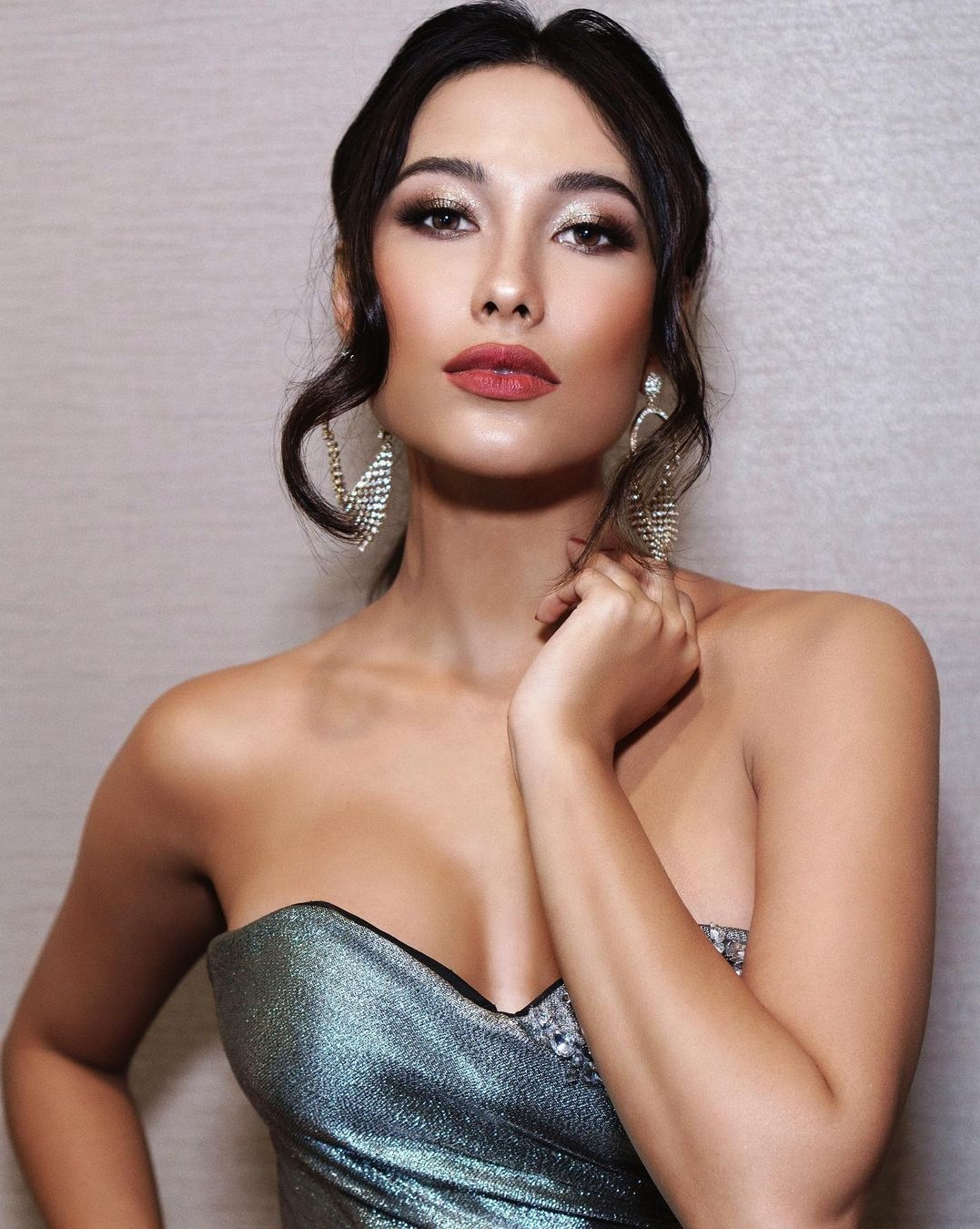 Hoa hậu Hoàn vũ Indonesia khổ sở vì bỏng mặt hậu thẩm mỹ ảnh 3