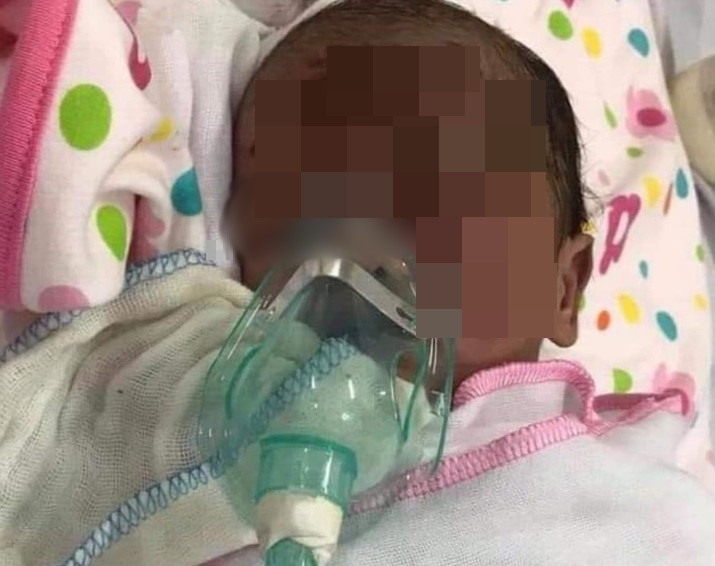 Bé trai sơ sinh bị bỏ rơi trên đường với nhiều vết xước trên mặt ảnh 1