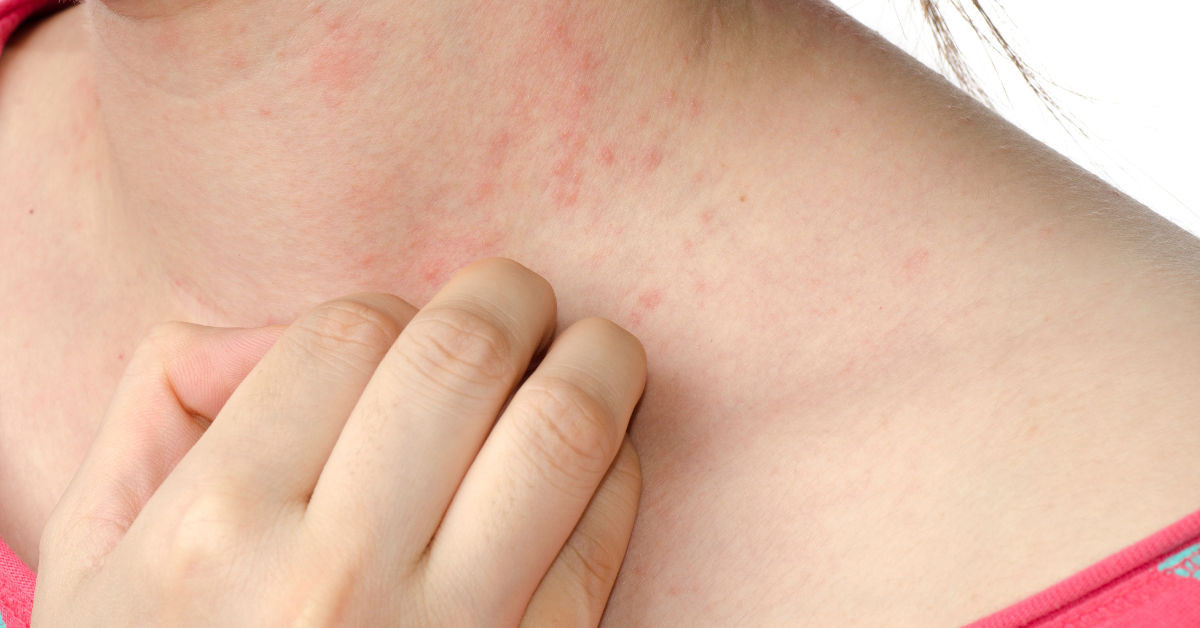 Hàu: Cực tốt và cực độc, biết mà tránh khi ăn khỏi 'rước họa vào thân' ảnh 4