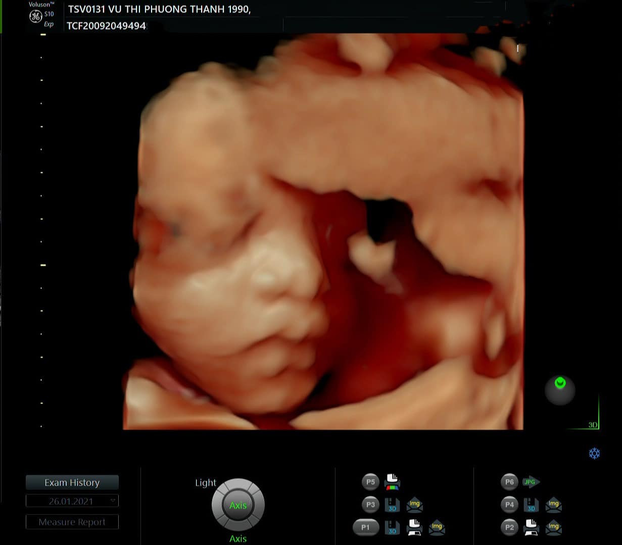 Bảo Thanh hạnh phúc lần đầu khoe ảnh siêu âm con gái sắp chào đời ảnh 1