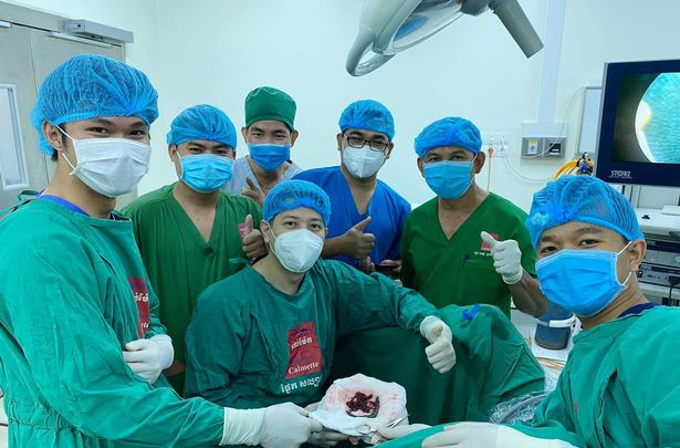 Phát hiện đỉa trong dương vật một người đàn ông, bác sĩ phẫu thuật “chết sững“ ảnh 4