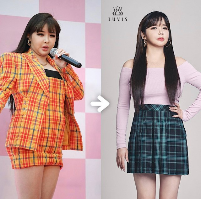 Park Bom xuất hiện hậu giảm 11 kg, “visual đỉnh cao” trực tiếp đối đầu với IU và Baekhyun ảnh 4