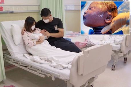 Phép màu y học khi một em bé sinh ra với dây rốn quấn cổ 6 vòng vẫn sống sót ảnh 8