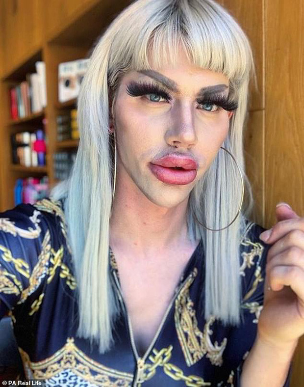 Chàng trai chật vật tìm bạn gái, chi 450 triệu đồng phẫu thuật giống búp bê Barbie ảnh 1