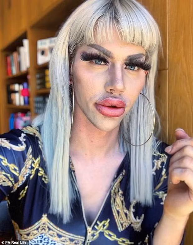 Chàng trai chật vật tìm bạn gái, chi 450 triệu đồng phẫu thuật giống búp bê Barbie ảnh 1