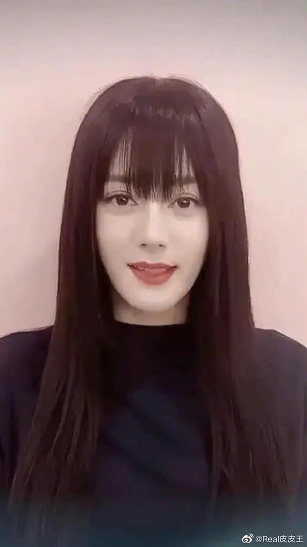 Giật mình với dung mạo như ông già 80 của Lý Minh Thuận ảnh 5