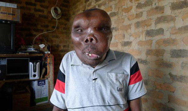 Bất ngờ với hình ảnh đám cưới lần ba của ‘người đàn ông xấu xí nhất thế giới’ ảnh 2