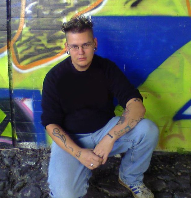 Kinh hãi trước gương mặt của ‘dị nhân’ Đức không tai, phẫu thuật 17 lần cho giống đầu lâu ảnh 3