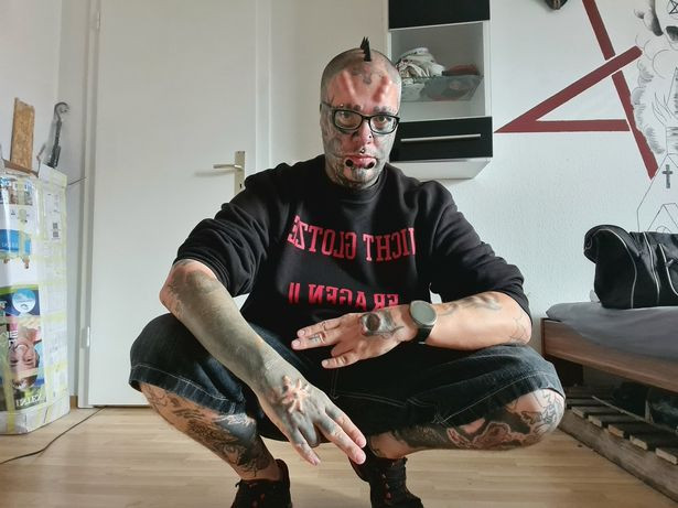 Kinh hãi trước gương mặt của ‘dị nhân’ Đức không tai, phẫu thuật 17 lần cho giống đầu lâu ảnh 6