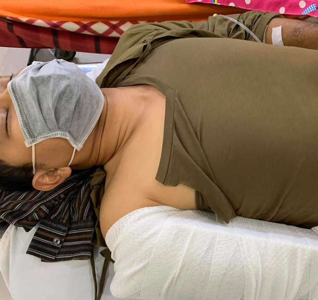 Diễn viên Huỳnh Đông bị tai nạn ngã gãy tay khi quay phim ảnh 1