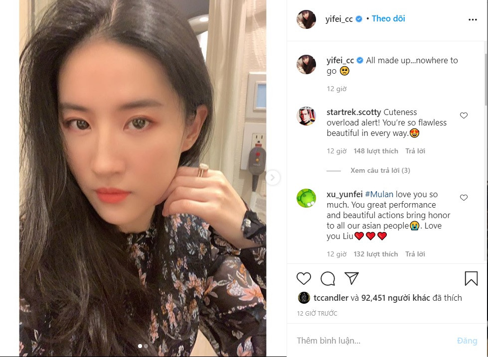 Nhan sắc Chương Tử Di xuống cấp thê thảm, lộ da chảy xệ, hói đầu sau sinh ảnh 12