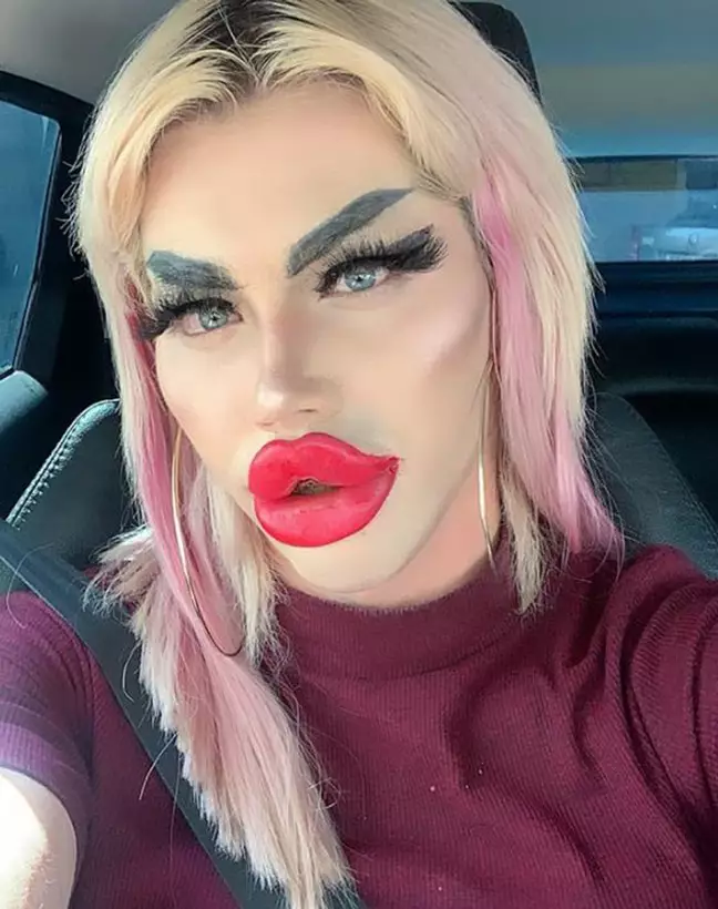 Chàng trai chật vật tìm bạn gái, chi 450 triệu đồng phẫu thuật giống búp bê Barbie ảnh 4