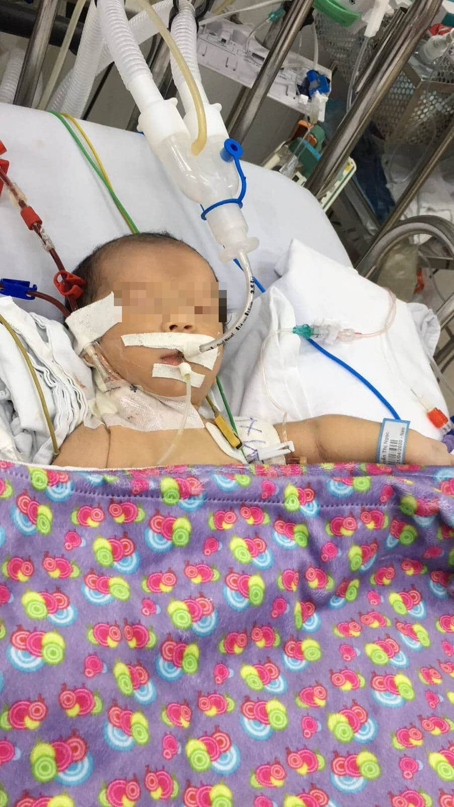 Lọc máu cứu sống trẻ sơ sinh bị bệnh hiếm ảnh 1