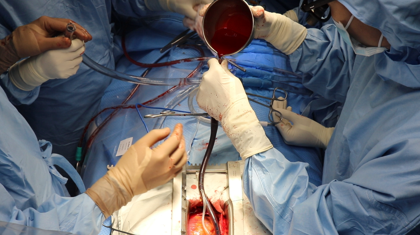 Bệnh viện tuyến quận đầu tiên cán mốc 100 ca mổ tim thành công ảnh 2