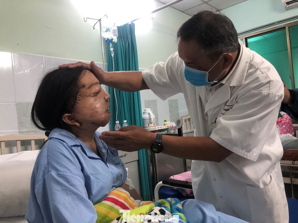 Cứu cô gái trẻ 22 năm mang 'khuôn mặt quỷ' ảnh 3