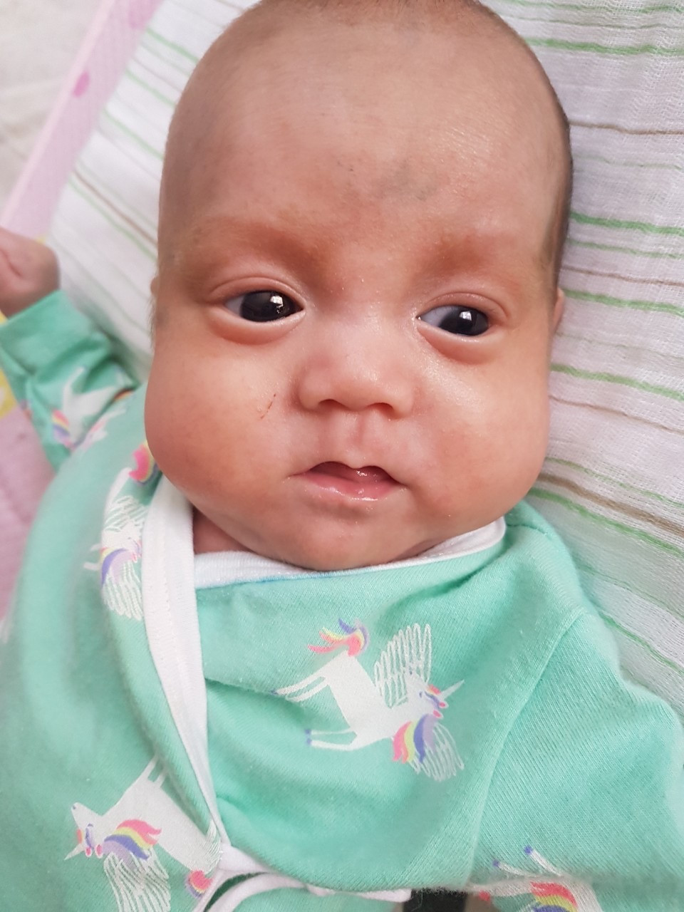 91 ngày giành giật sự sống cho ca sinh 3 khi mới 26 tuần tuổi ảnh 2