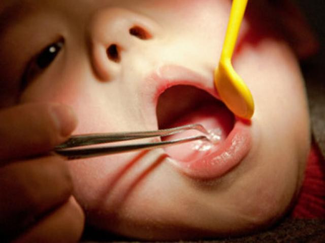 Ăn cháo lươn, bé gái 7 tháng tuổi suýt chết ảnh 1