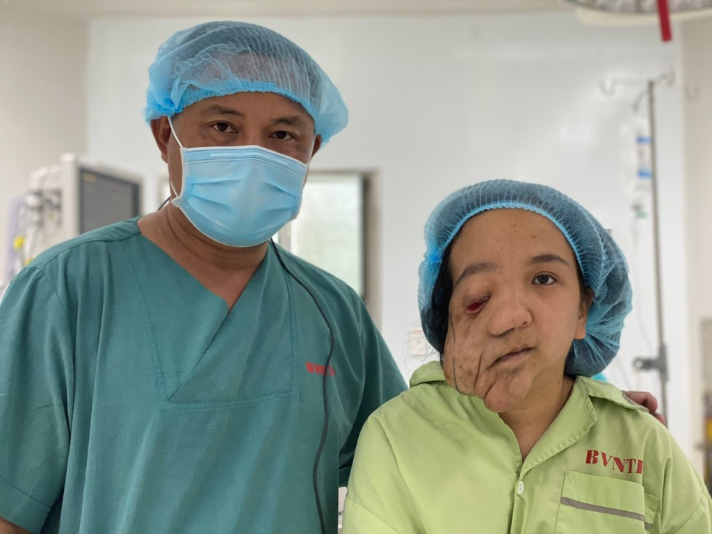 Cứu cô gái trẻ 22 năm mang 'khuôn mặt quỷ' ảnh 1