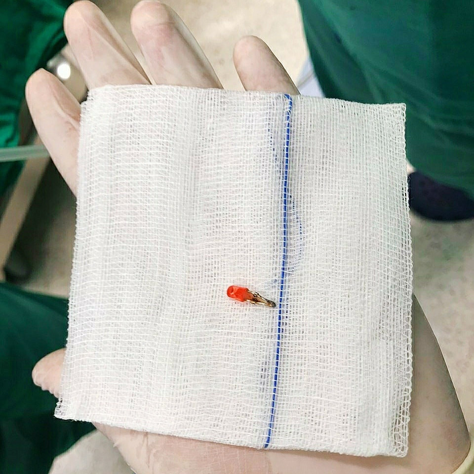 Nhiều trẻ hóc dị vật, uống nhầm hóa chất ảnh 3