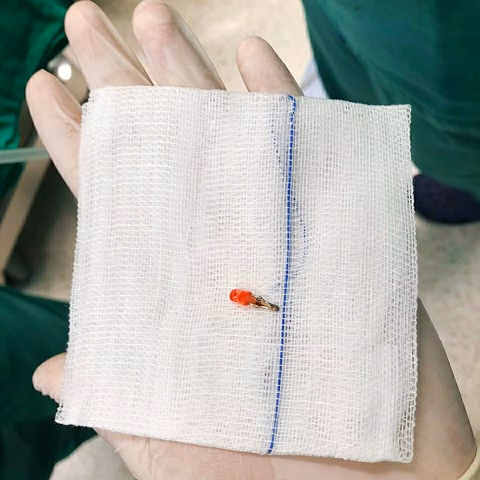 Nhiều trẻ hóc dị vật, uống nhầm hóa chất ảnh 3