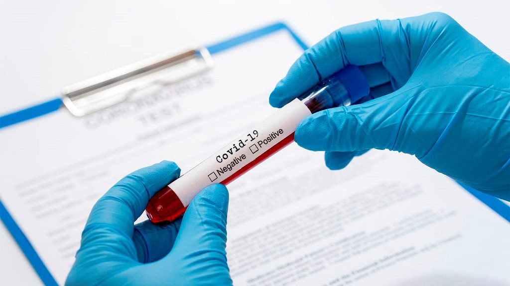 TPHCM: Có người là F1 của BN 1451, Viện Kiểm sát nhân dân Q.3 tạm đừng tiếp công dân ảnh 1