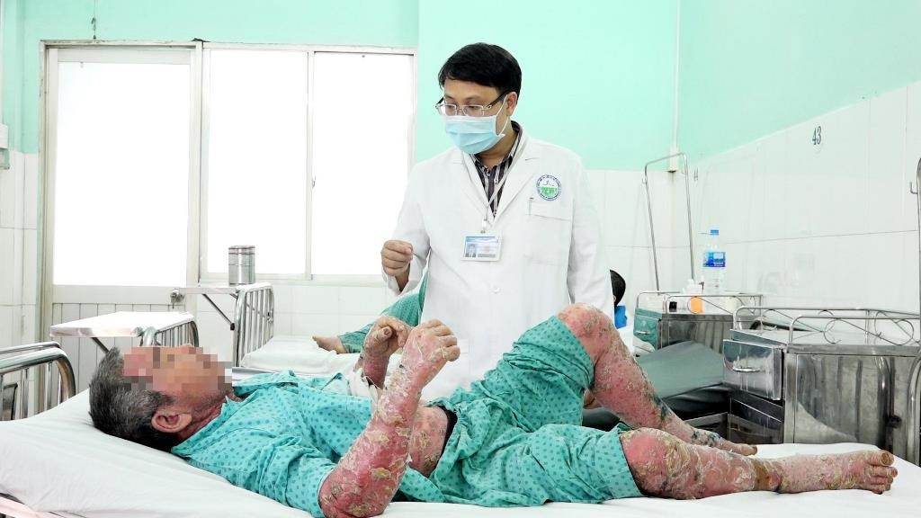 Ôm họa khi tự mua thuốc trên mạng ảnh 1