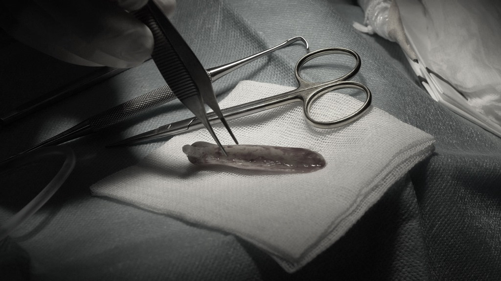 Tin 'bác sĩ Sài Gòn', người phụ nữ đứt lìa trụ mũi, đau như bị ngàn con ong chích ảnh 2