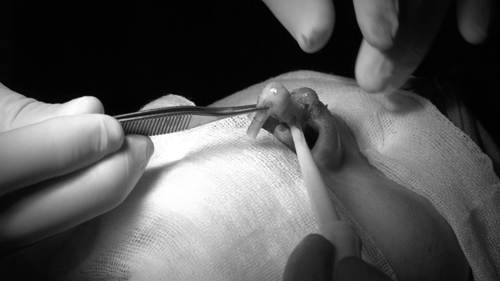 Tin 'bác sĩ Sài Gòn', người phụ nữ đứt lìa trụ mũi, đau như bị ngàn con ong chích ảnh 1