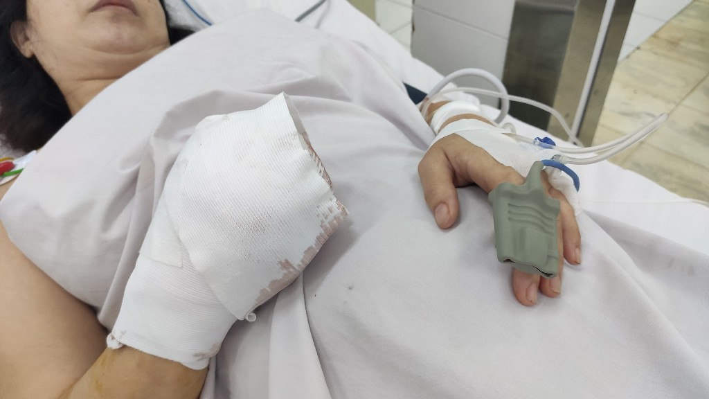 Bị máy cuốn nát bàn tay khi đang xay thịt nấu ăn ảnh 1