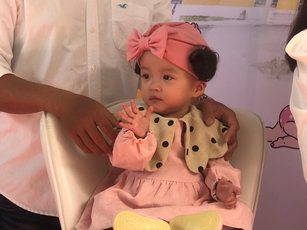 Những chuyện bác sỹ bây giờ mới dám kể về ca tách cặp Trúc Nhi – Diệu Nhi ảnh 2