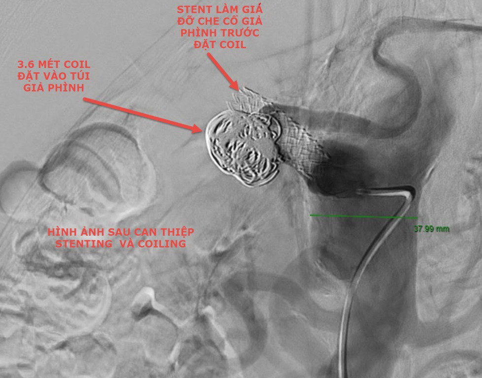 Cẩn trọng khi bỗng dưng nhức đầu, nôn ra máu ảnh 1