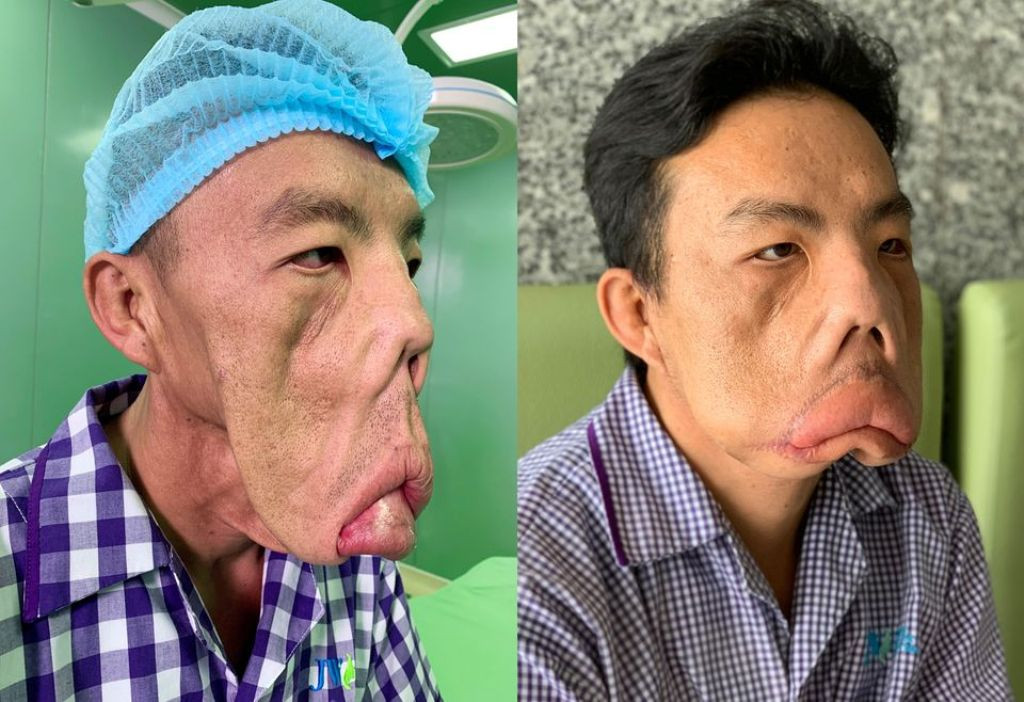 Tìm ra căn bệnh lạ của chàng trai 'mặt quỷ' ảnh 1