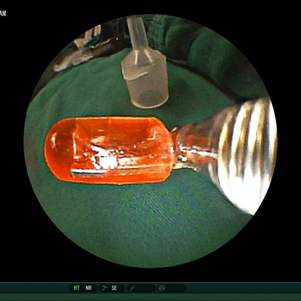 Nhiều trẻ hóc dị vật, uống nhầm hóa chất ảnh 2