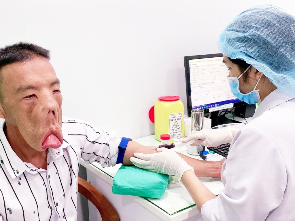 Tìm lại cuộc sống cho chàng trai 'mặt quỷ' ảnh 3