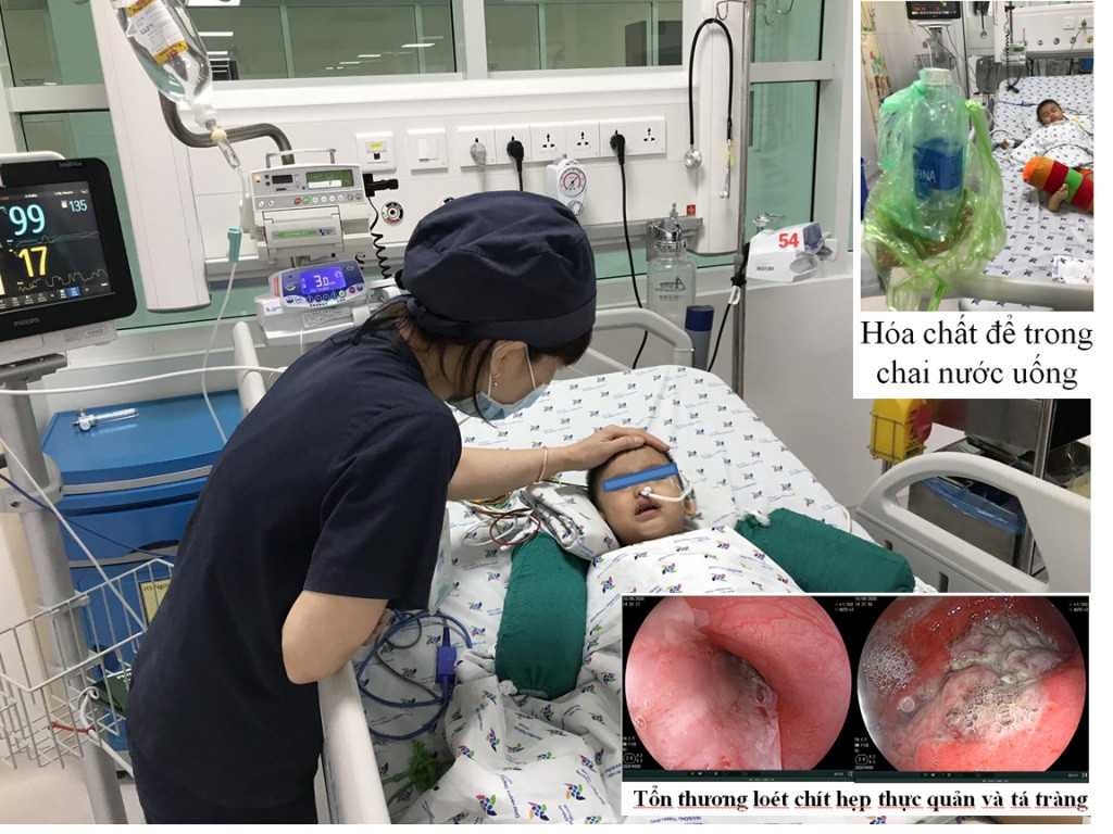 Bé 3 tuổi nguy kịch vì uống nhầm hóa chất ảnh 1