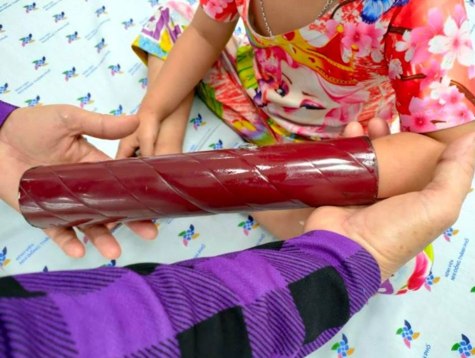 'Giải cứu' bé gái 3 tuổi kẹt cánh tay vào chân giường ảnh 1