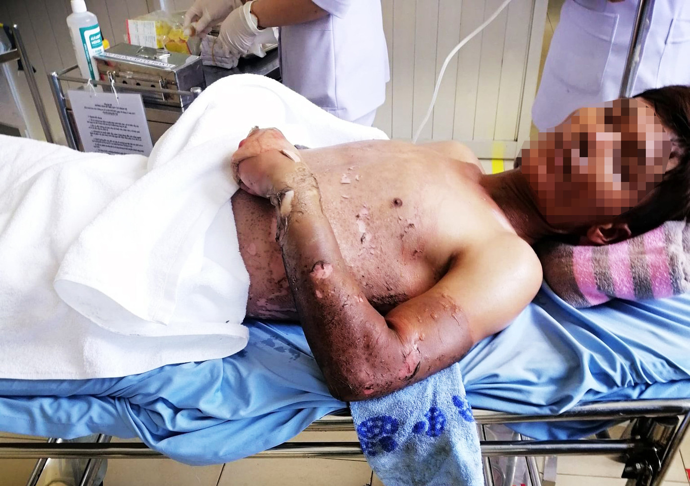 Thợ hàn bốc cháy vì bị điện giật, rơi từ độ cao 5m xuống đất ảnh 1