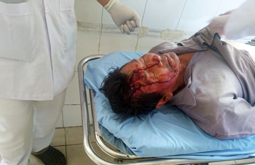 Đến 'xin' đất không được, vô cớ đánh người nhập viện ảnh 2