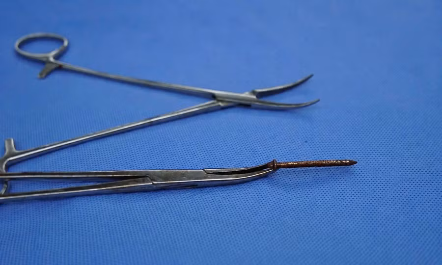 Cứu bệnh nhân bị đinh dài 4cm ghim thẳng vào bụng