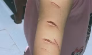 Học sinh lớp 5 ở Cà Mau bị chị họ dùng dao cắt giấy rạch nhiều nhát