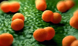 Cà Mau báo cáo 3 người nghi mắc não mô cầu,1 trường hợp đã tử vong