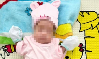 Cà Mau: Bé gái sinh non ở tuần thứ 25