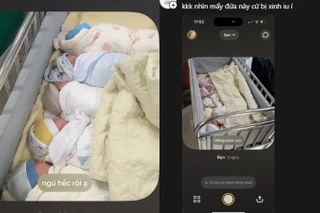 Locket của sinh viên Y đi khoa sản: Toàn ảnh "hội không răng" siêu dễ thương