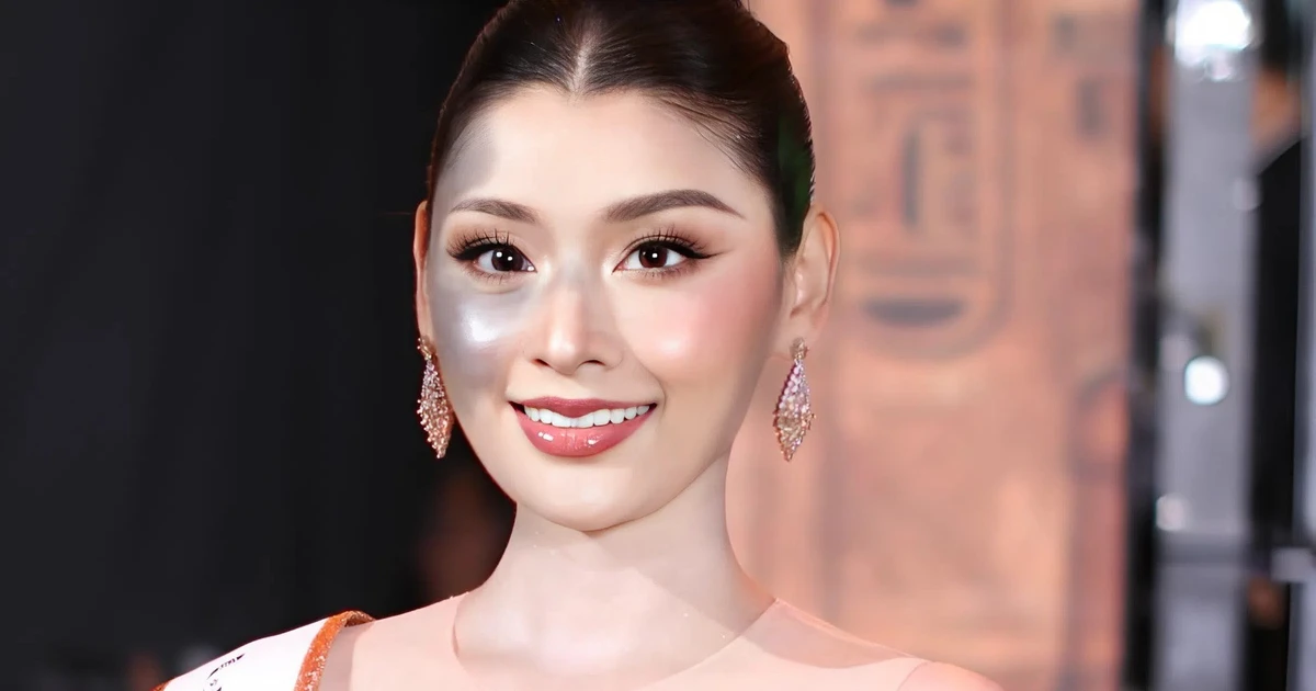 Người đẹp bị chàm nửa gương mặt giành giải á hậu