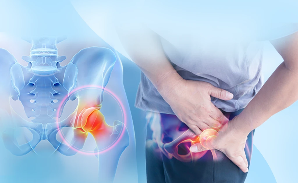 4 thói quen bào mòn khớp háng, nguy cơ khiến nhiều người phải ngồi xe lăn