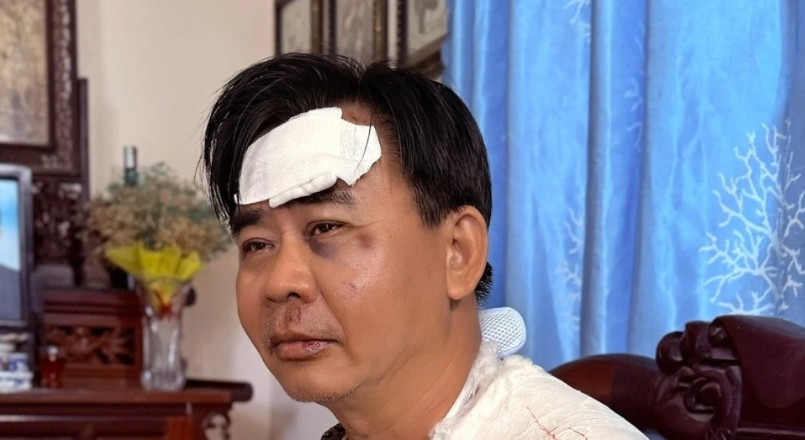 Tình trạng nghệ sĩ Chánh Thuận sau tai nạn xe