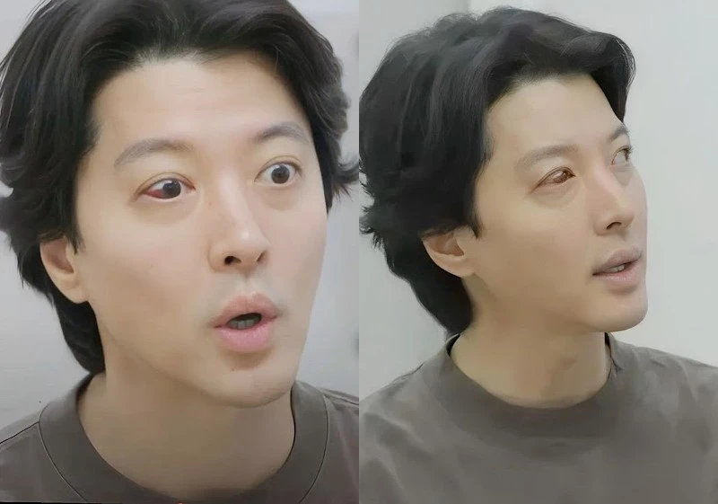 Nam diễn viên mắc bệnh chỉ 1% người Hàn Quốc gặp phải