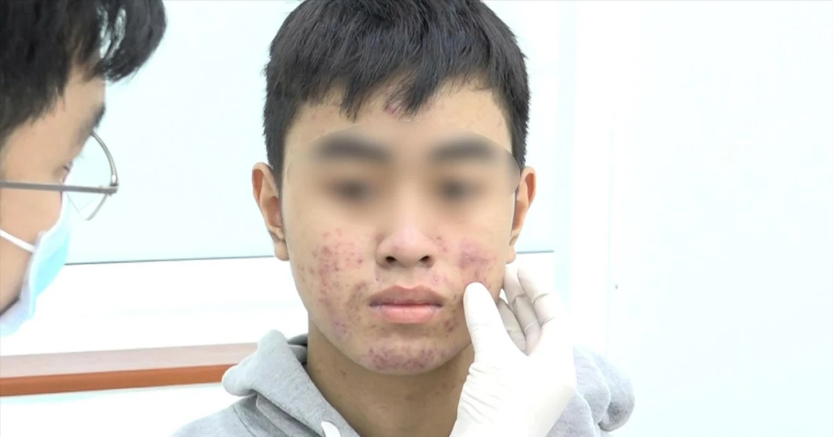 'Hàng hiệu' giá bèo từ chợ đến mạng - bài 2: Phía sau lời quảng cáo 'trắng cấp tốc'