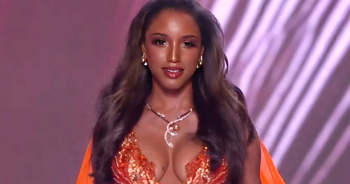 Thí sinh Hoa hậu Hoàn vũ té ngã, nhập viện ngay trong đêm bán kết